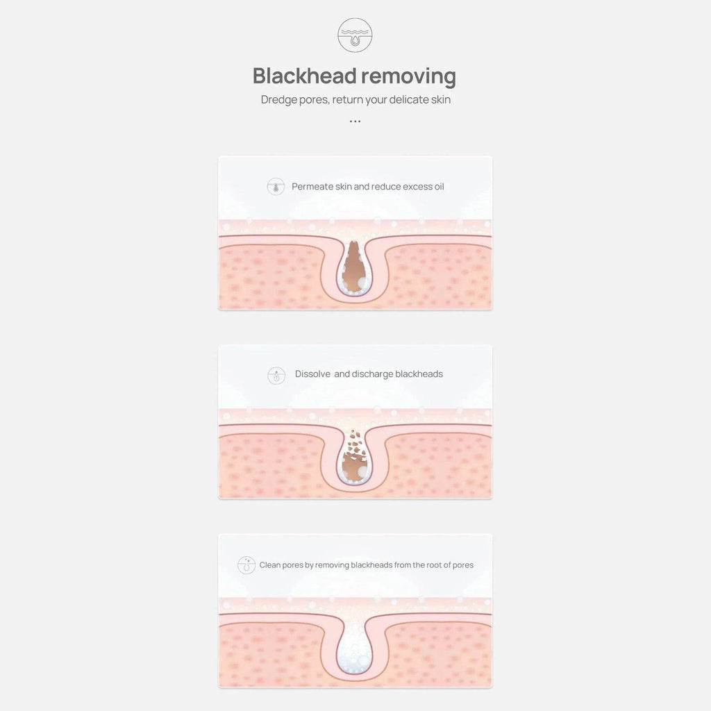 White Blackhead Remover Nose Mask - Givenco