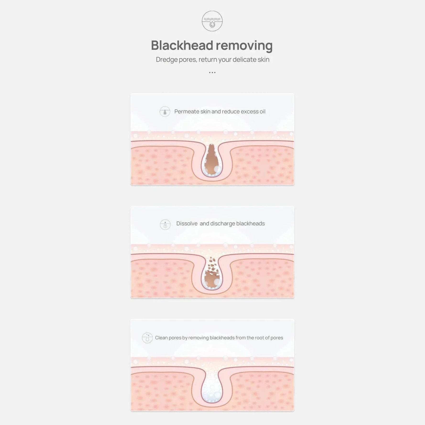 White Blackhead Remover Nose Mask - Givenco