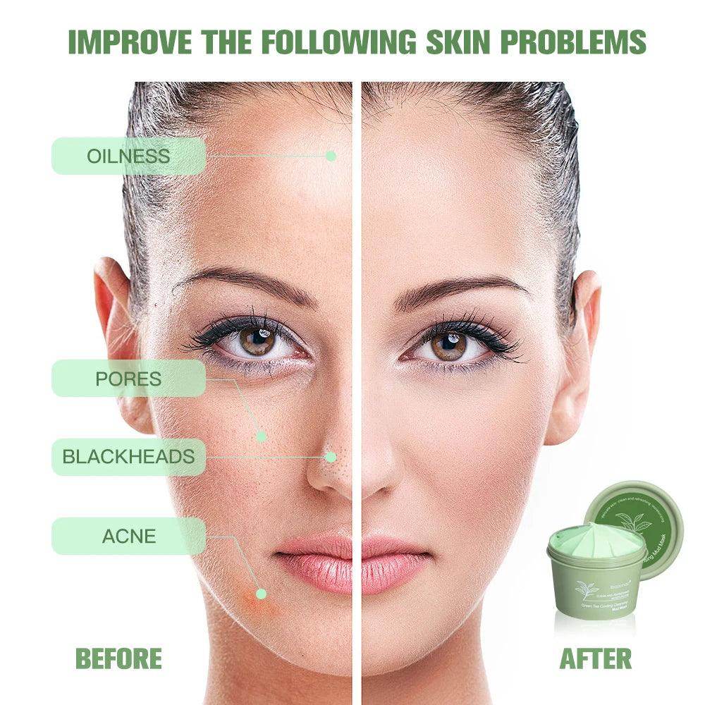 Natural Skincare Deeply Cleansing Pore - Givenco