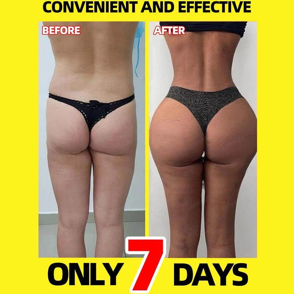 Lift Buttock - Givenco