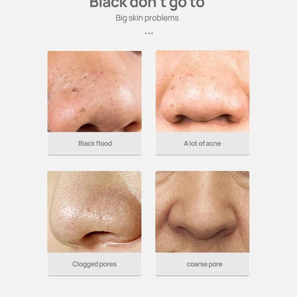 White Blackhead Remover Nose Mask - Givenco