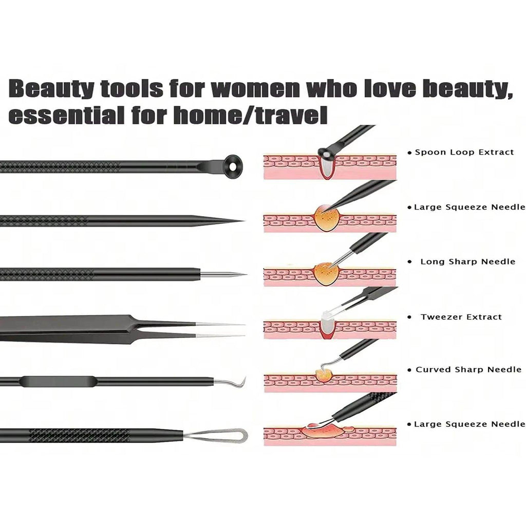 Blackhead Remover Clip Acne Needle - Givenco
