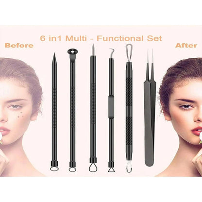 Blackhead Remover Clip Acne Needle - 